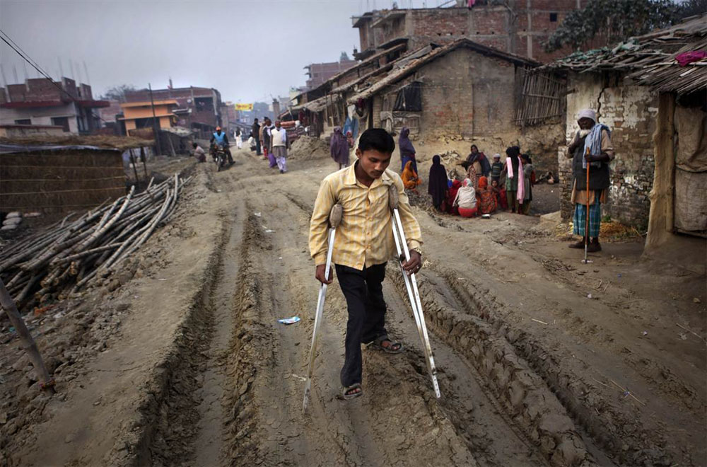 polio case